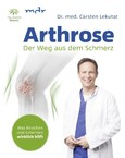 Arthrose