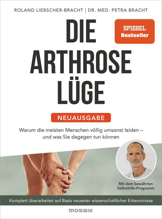 Die Arthrose-Lüge